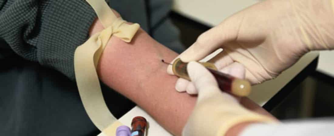 UNITED STATES SUPREME COURT REQUIRES WARRANTS FOR FORCED BLOOD DRAWS