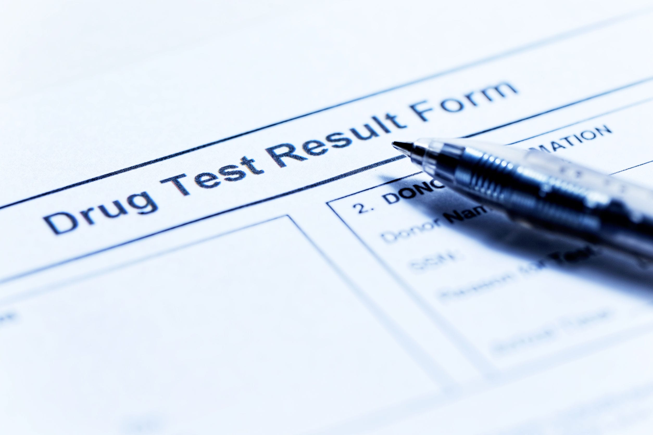 If You Fail a Drug Test at Work, Can You Be Charged in Illinois?